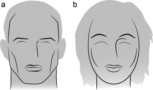facial feminization